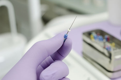 Endodoncia