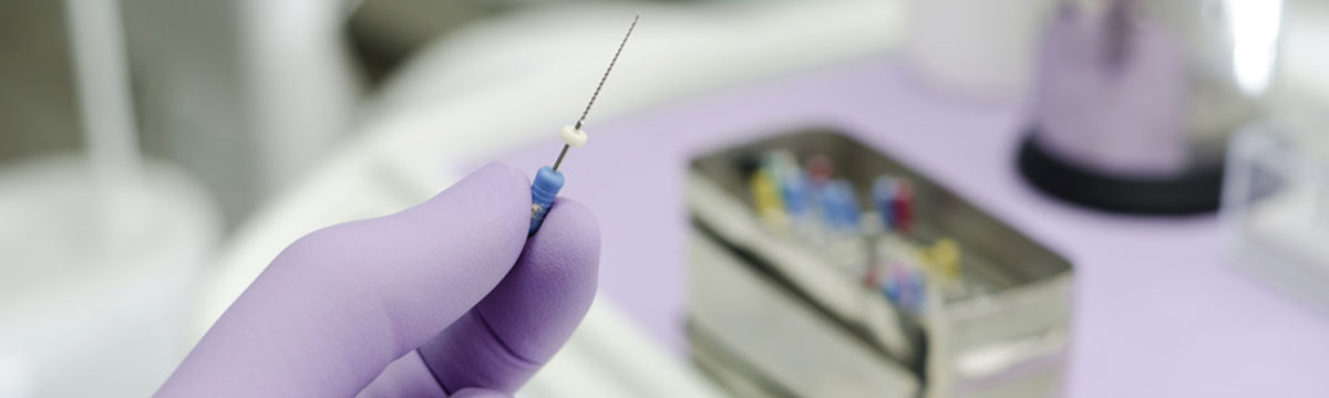 endodoncia en Medina del Campo