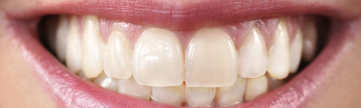 estética dental en Medina del Campo