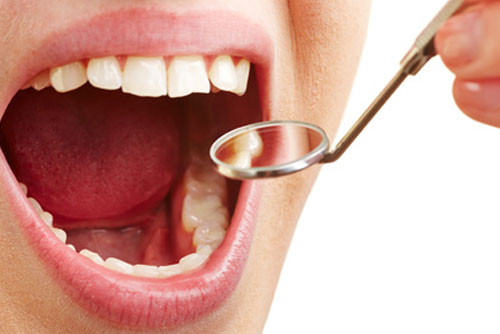 Estética Dental