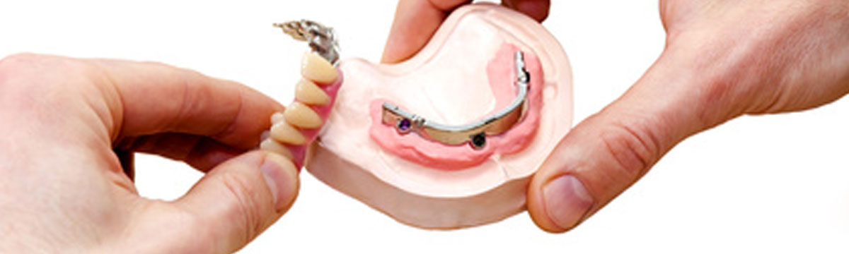 prótesis dentales en Medina del Campo