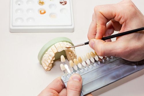 Prótesis Dentales